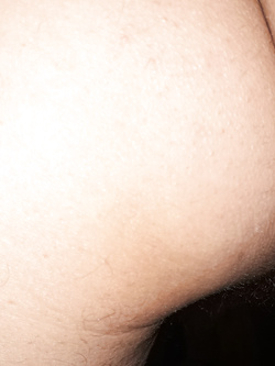 anal3