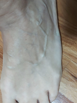 Piedi Parte 10