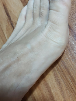 Piedi Parte 10