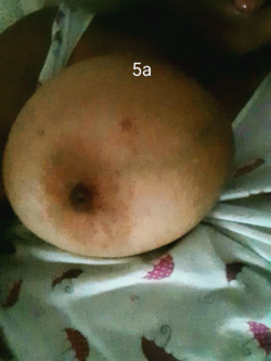 Tettona Parte 10
