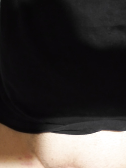 Depilato Parte 7