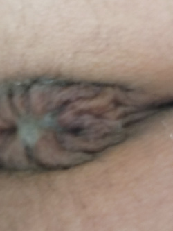 ass 3 Parte 6
