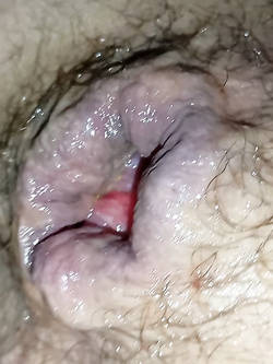 ass 2 Parte 6