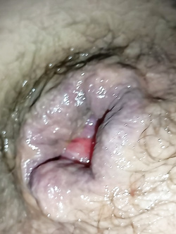 ass 2 Parte 6