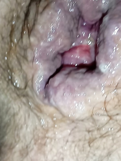 ass 2 Parte 6