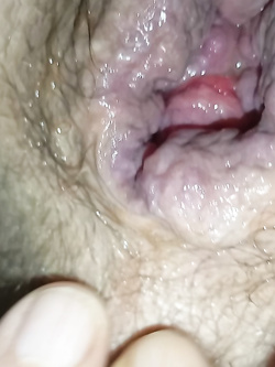 ass 2 Parte 6