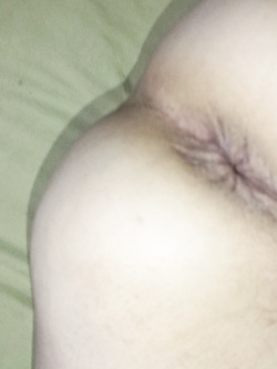 ass depilation
