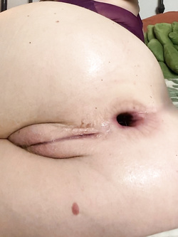 Culi aperti dopo essere fistati