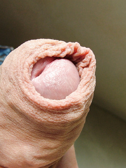 pisello Parte 2