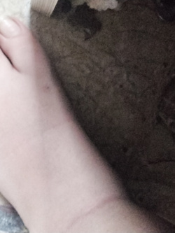 I piedi