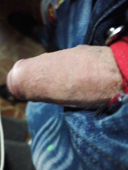 23 cm duro