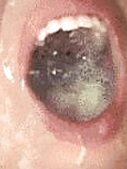 ESPERIENZE AMATORIALI