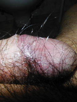 Il mio corpo durante una vacanza in hotel nel 2022