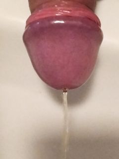 La cappella s'ingrossa